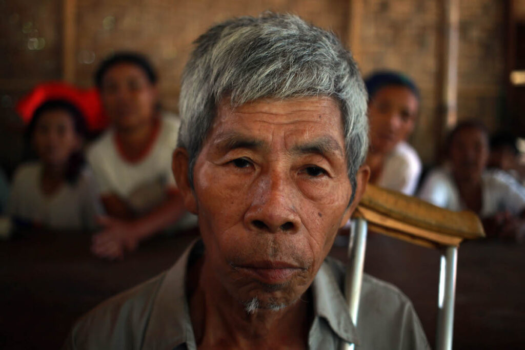 Magi Naw, 70, waits for his turn to meet Medical Doctor at the Je Yang IDP Camp in Kachin State.